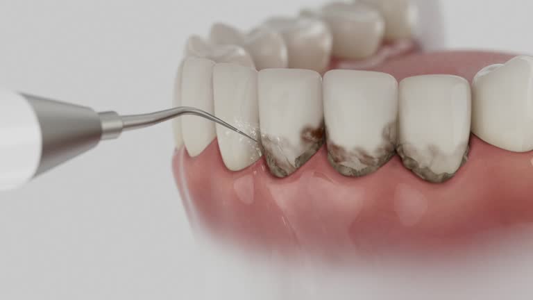 Reliable Dental Implants contractor in Williams, CA by Smile Center Dentistry